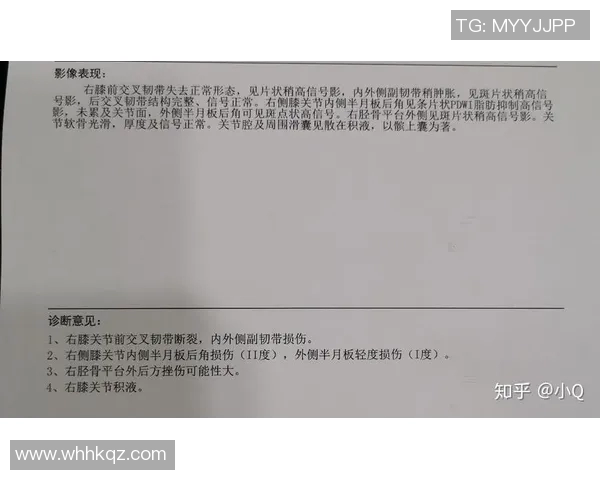 足球明星前交叉韧带重建手术的康复之路与运动生涯的影响分析 足球明星前交叉韧带重建手术的康复之路与运动生涯的影响分析